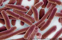 Tuberculose e causado por virus ou bacteria